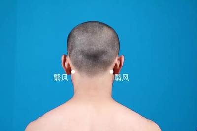 甲状腺DDS调理手法 DDS生物电手册 第1张