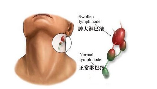 身上三处淋巴,决定了90%的疾病?生物电帮忙解决这难题。 DDS生物电手册 第4张 身上三处淋巴,决定了90%的疾病?生物电帮忙解决这难题。 DDS生物电手册 第4张