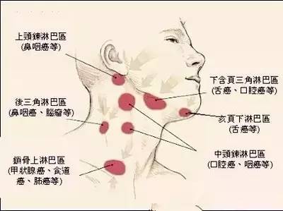 身上三处淋巴,决定了90%的疾病?生物电帮忙解决这难题。 DDS生物电手册 第5张 身上三处淋巴,决定了90%的疾病?生物电帮忙解决这难题。 DDS生物电手册 第5张