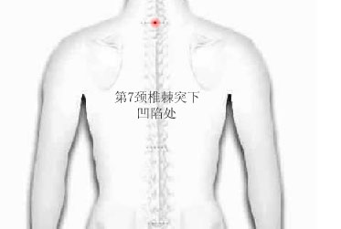 DDS手册：颈椎病的调理手法 DDS生物电手册 第2张