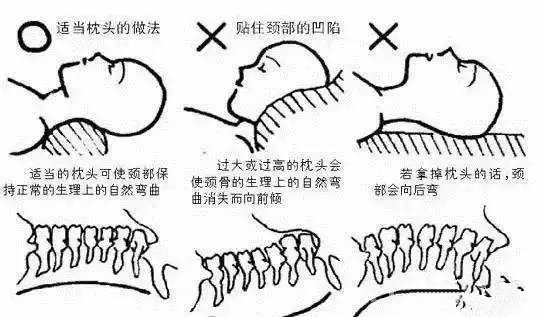 几个化解脖子上富贵包的方法 养生之道 第6张