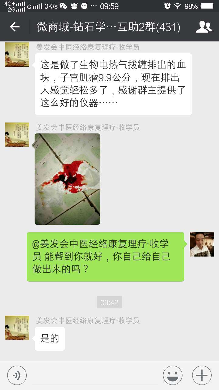 子宫肌瘤朋友的福音，拔罐生物电热疗可快速让瘀血脱落 DDS生物电手册 第2张