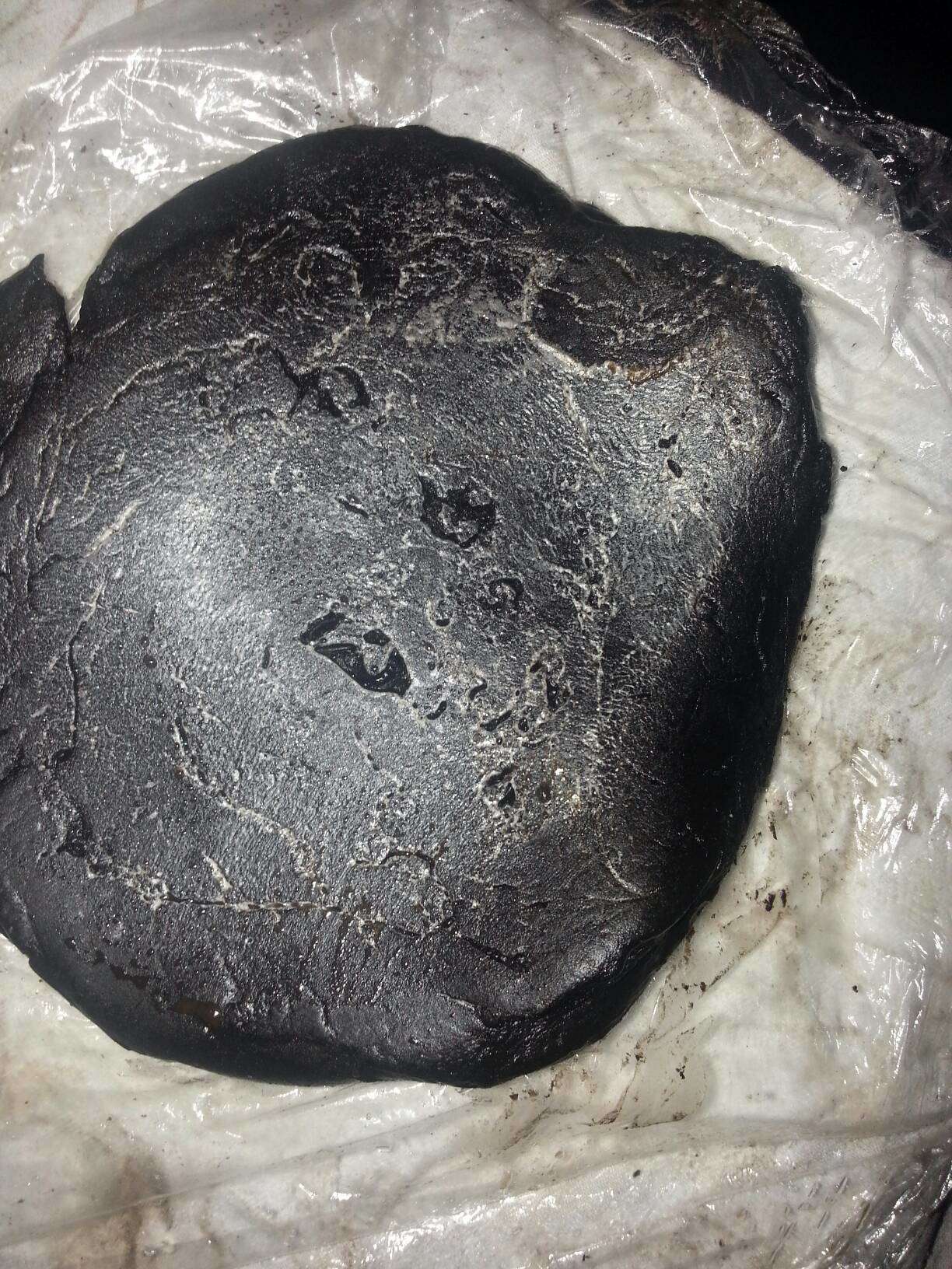 泥疗膏拔出的实例图解 DDS生物电手册 第2张