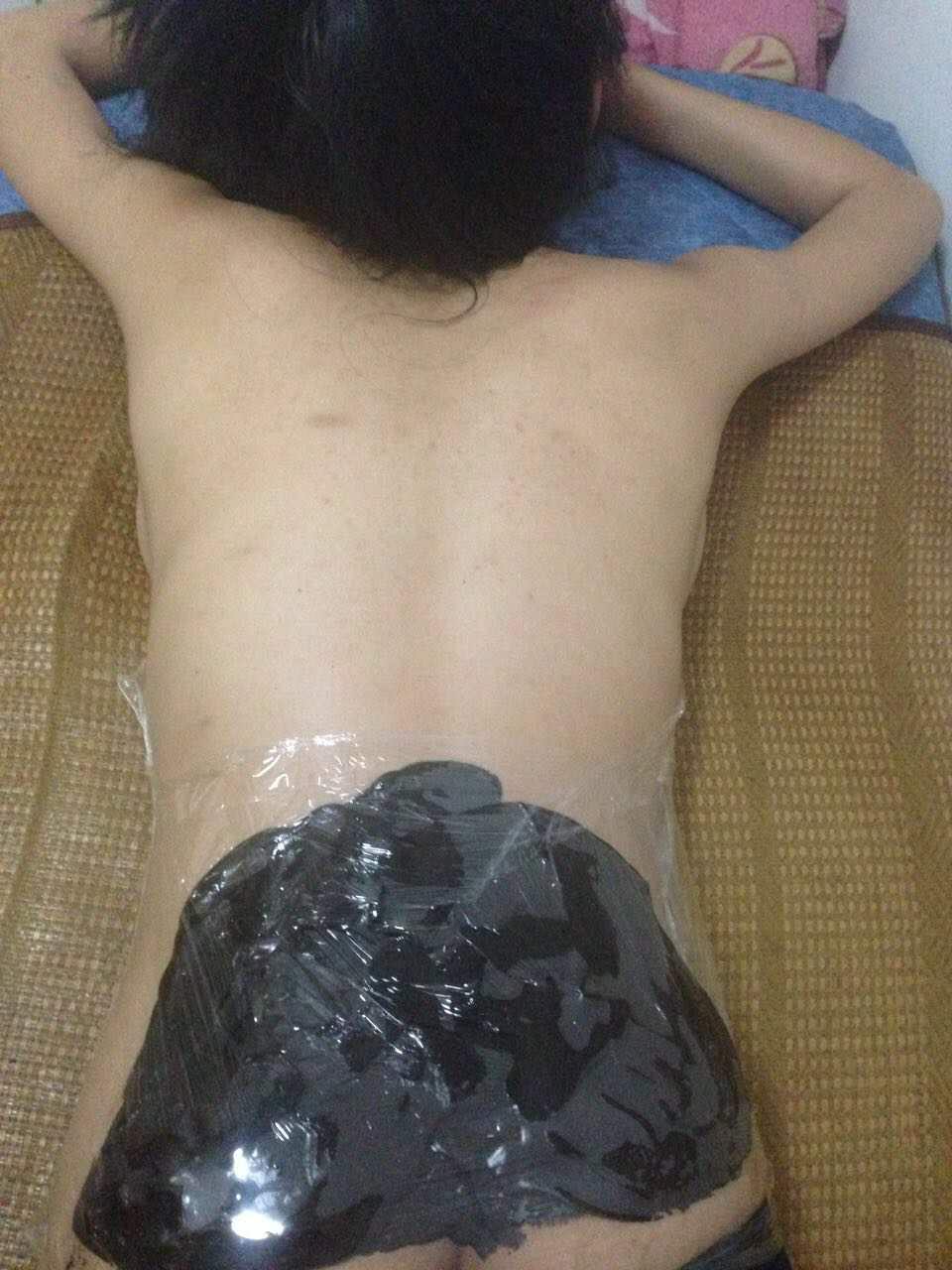泥疗膏拔出的实例图解 DDS生物电手册 第5张